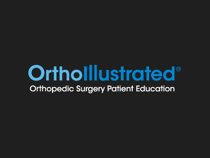 OrthoIllustrated