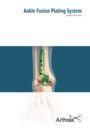 Ankle Fusion Plating System