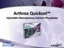 Arthrex Quickset™ Physician Presentation