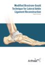 Modified Brostrom-Gould Technique for Lateral Ankle Ligament Reconstruction