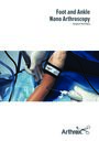 Foot and Ankle Nano Arthroscopy