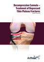 Decompression Cannula – Treatment of Depressed Tibia Plateau Fractures
