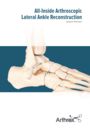 All-Inside Arthroscopic Lateral Ankle Reconstruction