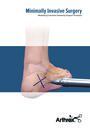 Minimally Invasive Surgery - Medializing Calcaneal Osteotomy Surgical Technique