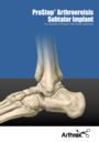 ProStop® Arthroereisis Subtalar Implant - For Correction of Posterior Tibial Tendon Dysfunction
