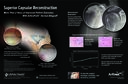 Superior Capsular Reconstruction - More Than 2 Years of Improved Patient Outcomes With ArthroFLEX Dermal Allograft