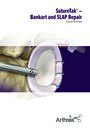 SutureTak® Bankart and SLAP Repair