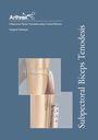 Subpectoral Biceps Tenodesis using Cortical Buttons