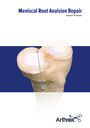 Meniscal Root Avulsion Repair