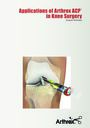 Applications of Arthrex ACP® in Knee Surgery