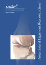 Anterolateral Ligament Reconstruction