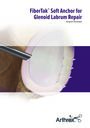 FiberTak®  Suture Anchor Glenoid Labrum Repair