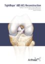 TightRope® ABS ACL Reconstruction