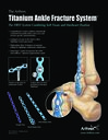 The Arthrex Titanium Ankle Fracture System™