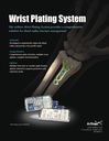 Wrist Plating System