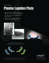 The Arthrex Plantar Lapidus Plate