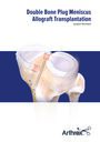 Double Bone Plug Meniscus Reconstruction