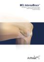 MCL InternalBrace™
