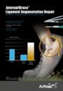 InternalBrace™ Ligament Augmentation Repair