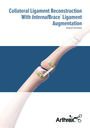 Collateral Ligament Reconstruction With InternalBrace™ Ligament Augmentation