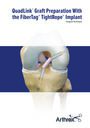 QuadLink™ Graft Preparation With the FiberTag® TightRope® Implant