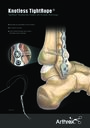 Knotless TightRope® - TightRope® Syndesmotic Fixation with Knotless Technology!