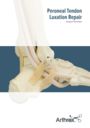 Peroneal Tendon Luxation Repair