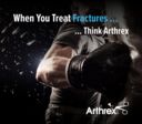 When You Treat Fractures ... Think Arthrex
