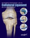 Pioneering Innovation with the Collateral Ligament Reconstruction Set