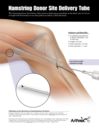 Hamstring Donor Site Delivery Tube