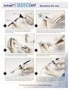 Arthrex Quickset™ Directions For Use