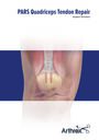 PARS Quadriceps Tendon Repair