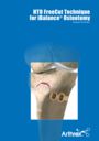 HTO FreeCut Technique for iBalance® Osteotomy