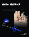 Weil or Weil Not? – Complete Plantar Plate Repair (CPR™) Viper™Instrument