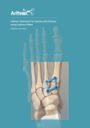 Lisfranc Reduction for Injuries and Fusions using Lisfranc Plates