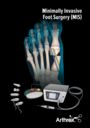 Minimally Invasive Foot Surgery (MIS)