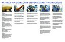 Arthrex Hip Distractor System Assembly Instructions