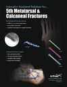 Innovative Treatment Solutions for 5th Metatarsal & Calcaneal Fractures