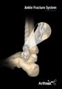 Ankle Fracture System