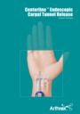 Centerline Endoscopic Carpal Tunnel Release