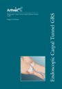 Endoscopic Carpal Tunnel Guided Release System (GRS)