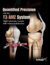 Quantified Precision with the T3 AMZ System - Tibial Tuberosity Transfer with Anteromedialization
