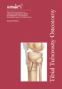 Tibial Tuberosity Osteotomy with Anteromedialization (AMZ) for Realignment of the Extensor Mechanism using the T3 AMZ System