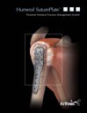 Humeral SuturePlate™ - Proximal Humeral Fracture Management System