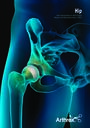 Hip - Next Generation in Soft Tissue Repair and Reconstruction 2019