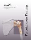 Percutaneous Humeral Fracture Repair