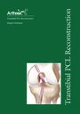 Transtibial PCL Reconstruction