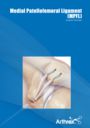 Medial Patellofemoral Ligament (MPFL)