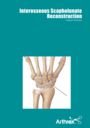 Interosseous Scapholunate Reconstruction