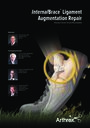 InternalBrace™ Ligament Augmentation Repair - Faculty Forum Virtual Roundtable